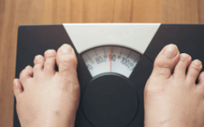什么是抽脂减肥 